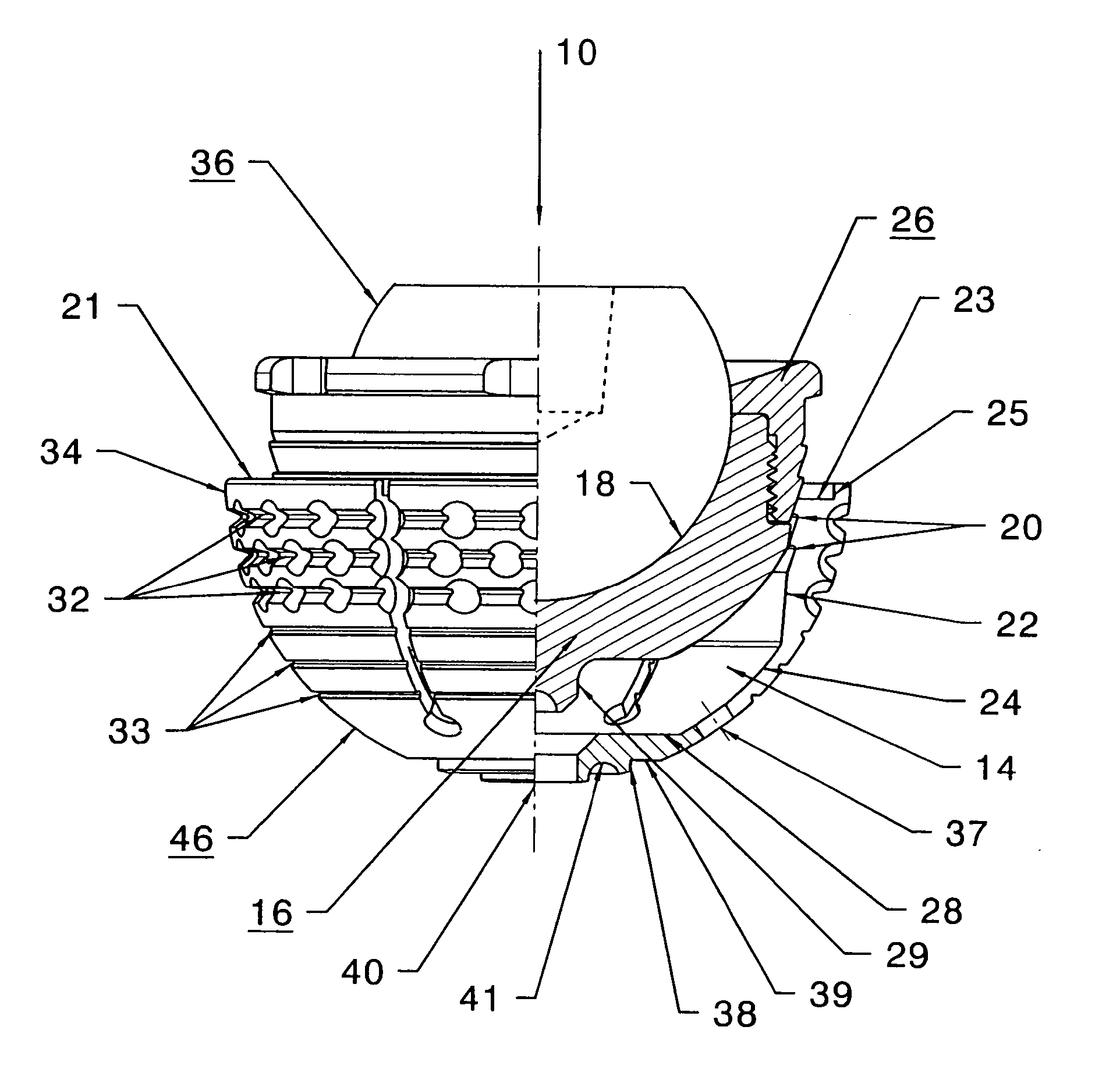 Expandable, supporting acetabular cup