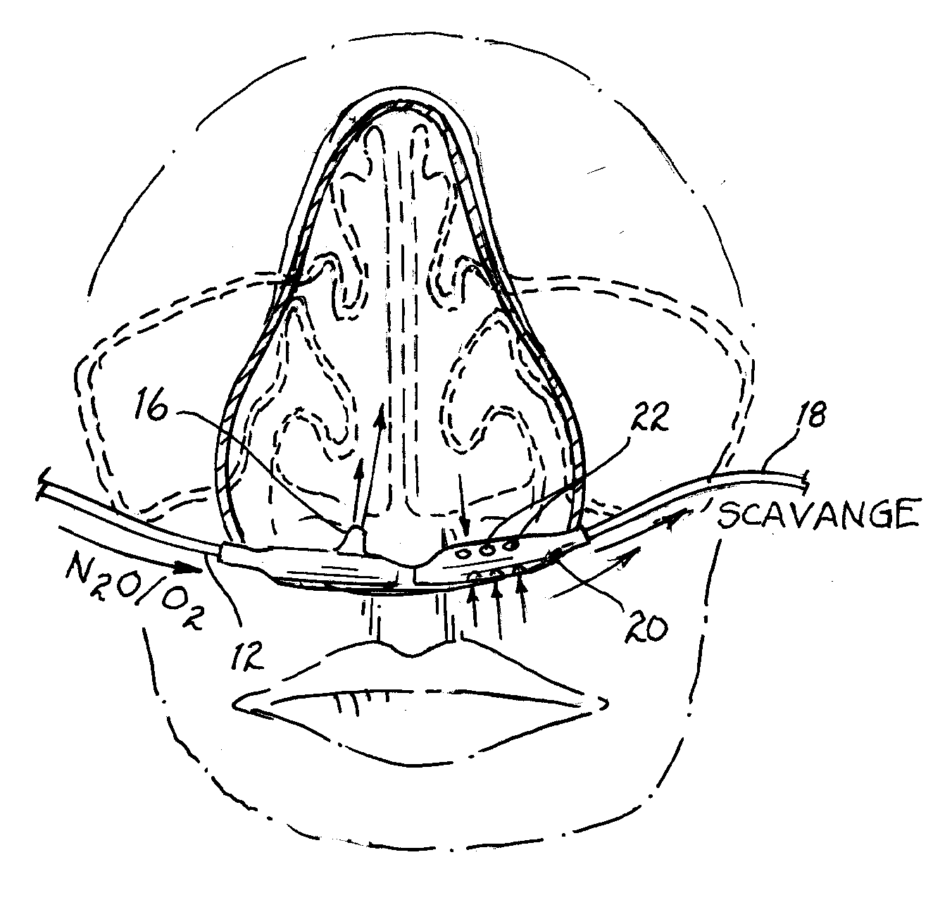 Nasal mask