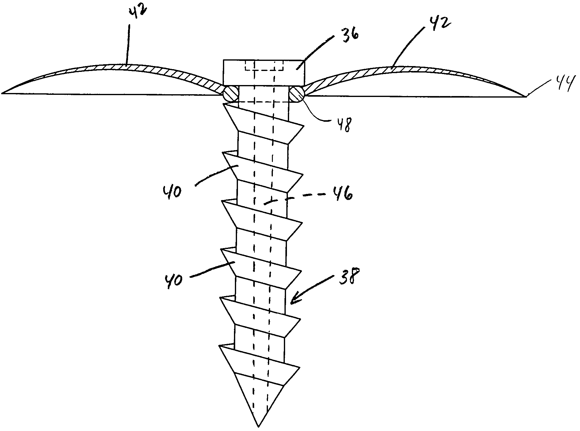 Method and apparatus for repair of torn rotator cuff tendons