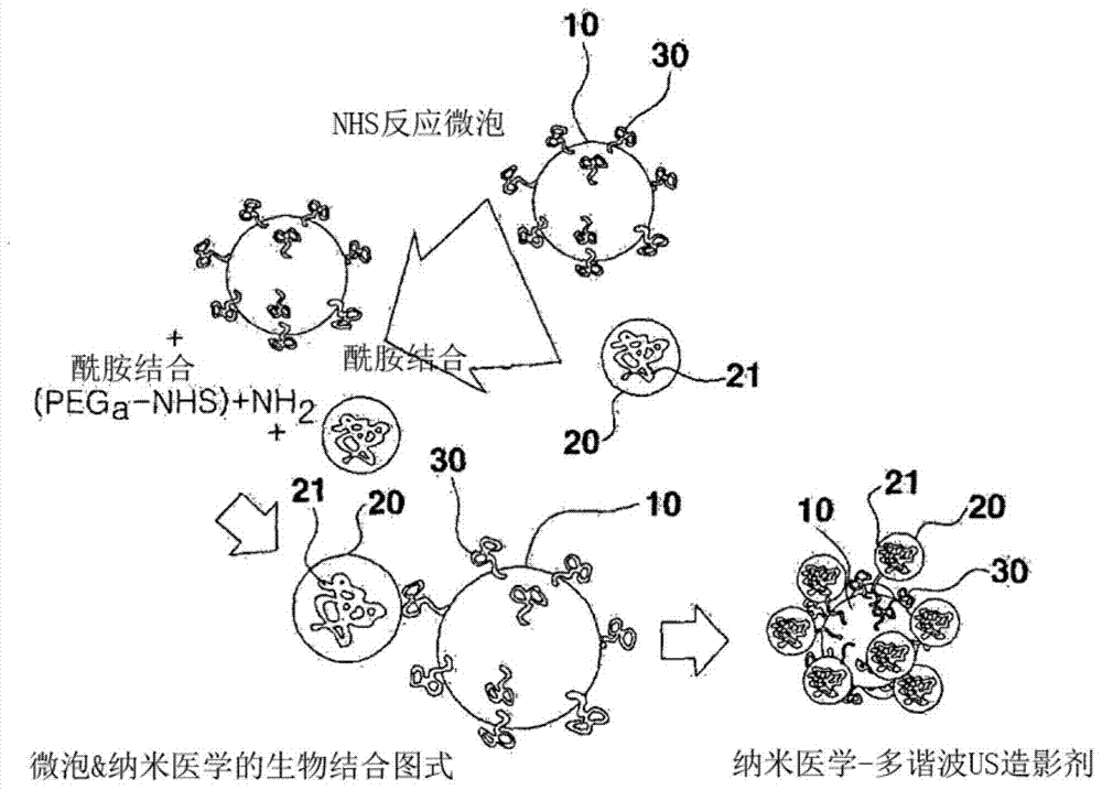 Ultrasound contrast medium in which nanoparticles containing drug are combined, and preparation method therefor