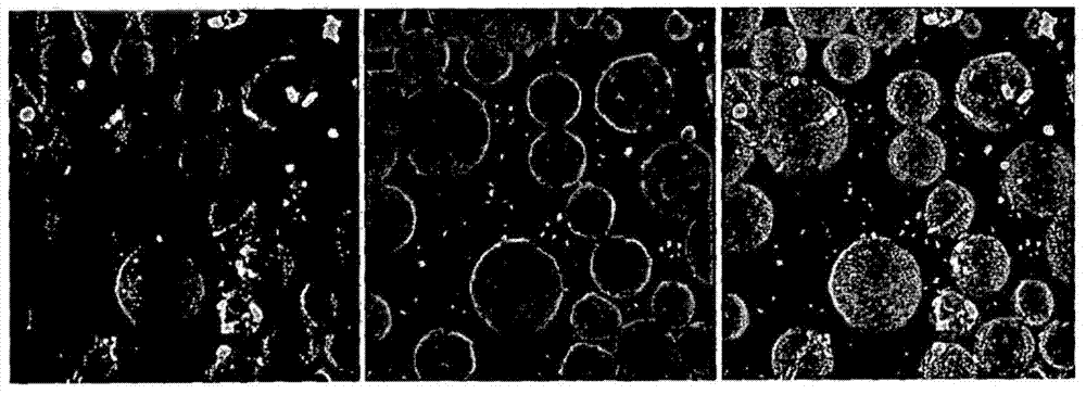 Ultrasound contrast medium in which nanoparticles containing drug are combined, and preparation method therefor