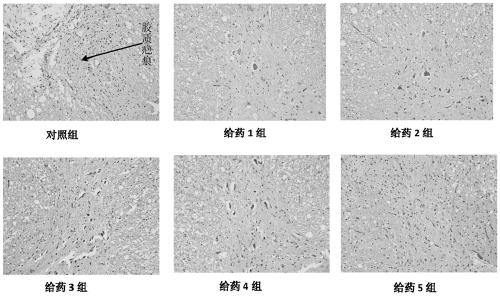 Anti-NgR and anti-NG2 mixed polypeptide vaccine, and application thereof in spinal cord injury repair