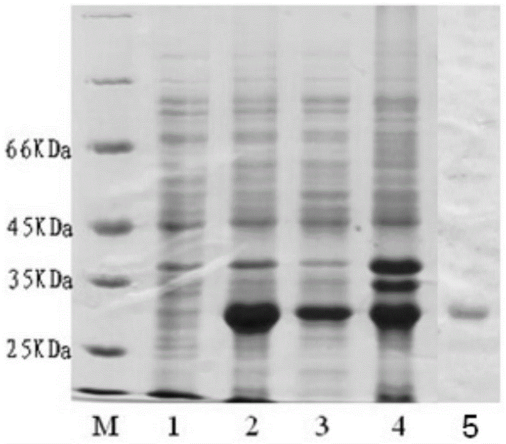 A (-) γ-lactamase with the activity of splitting racemate γ-lactam and its encoding gene and application