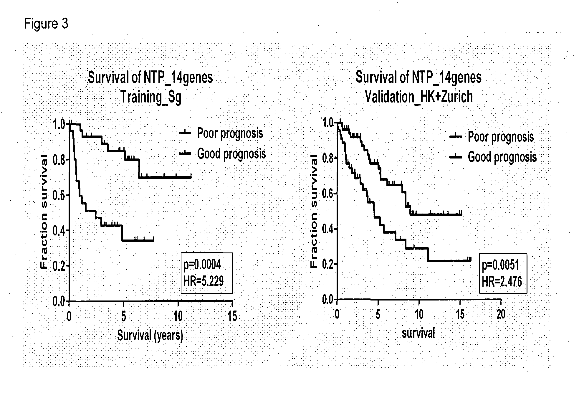 Gene signatures for use with hepatocellular carcinoma