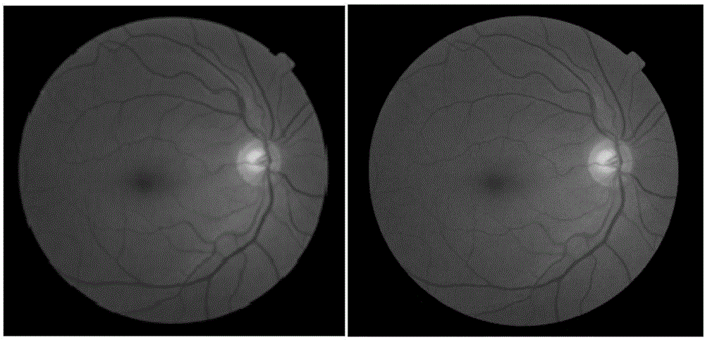 Automatic detection method for microaneurysm in eye fundus image on basis of local entropy determining threshold