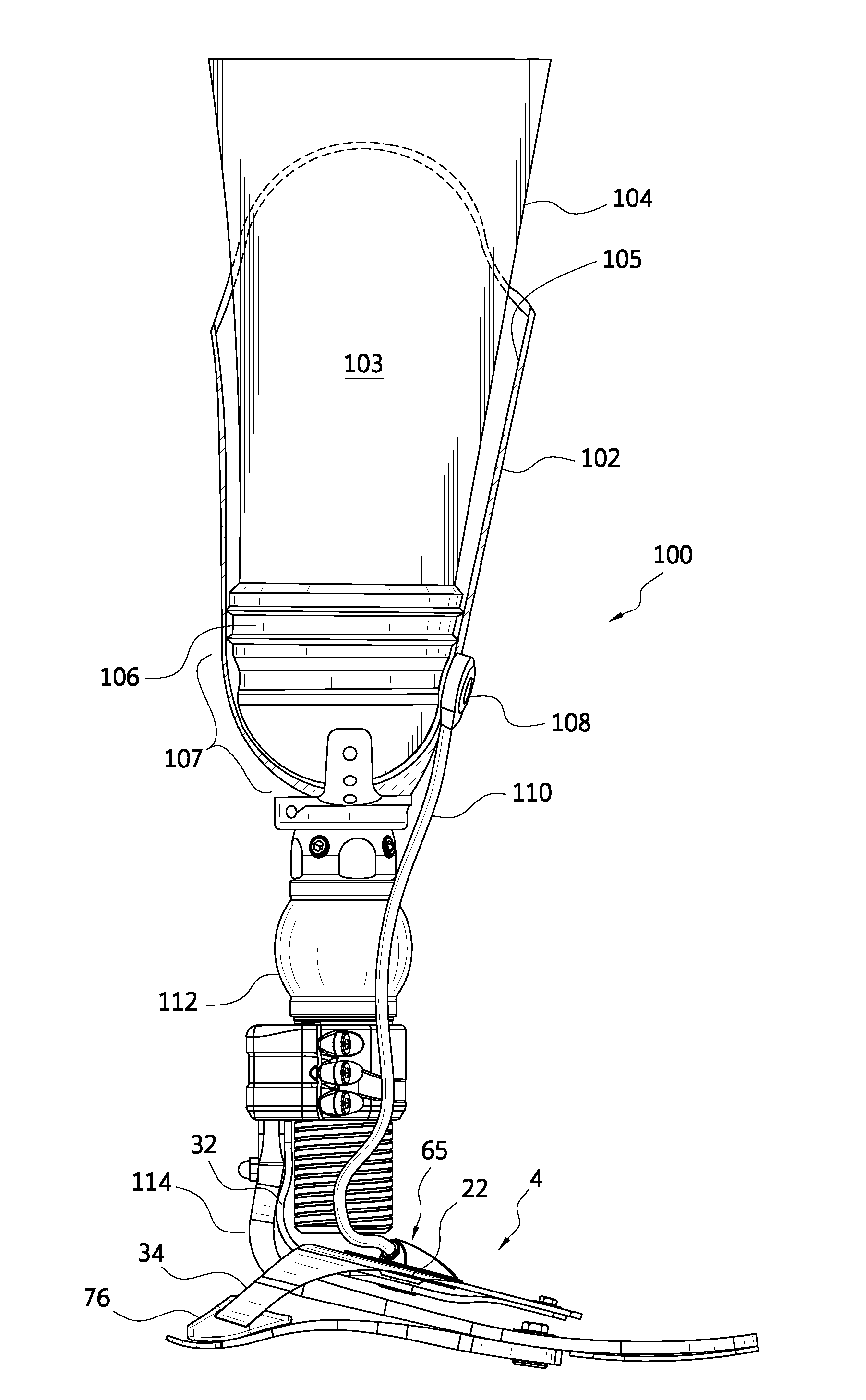 Prosthetic device, system and method for increasing vacuum attachment