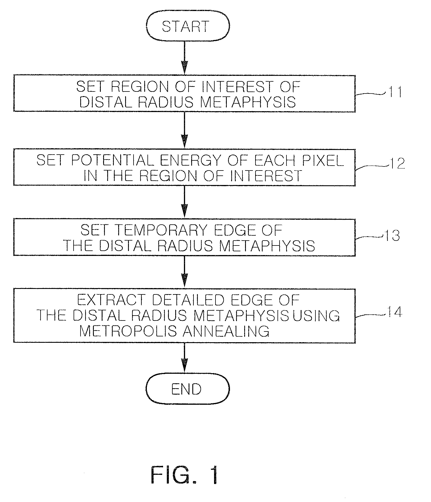 Method and system for extracting distal radius metaphysis