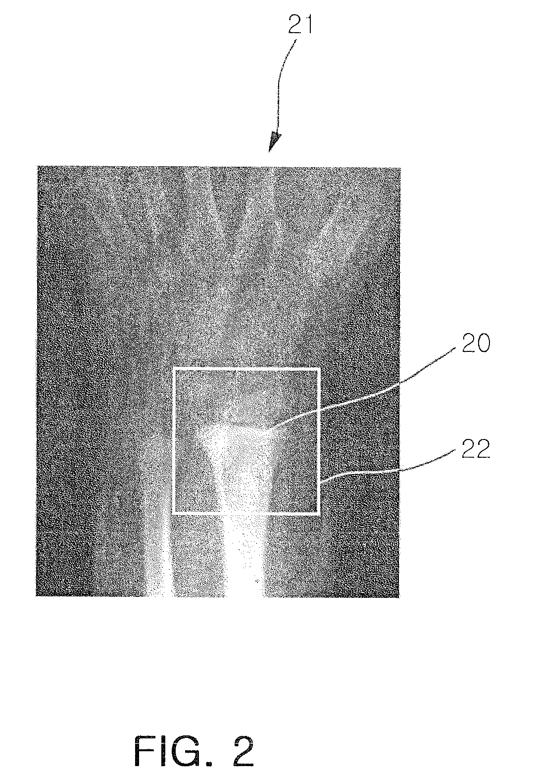 Method and system for extracting distal radius metaphysis