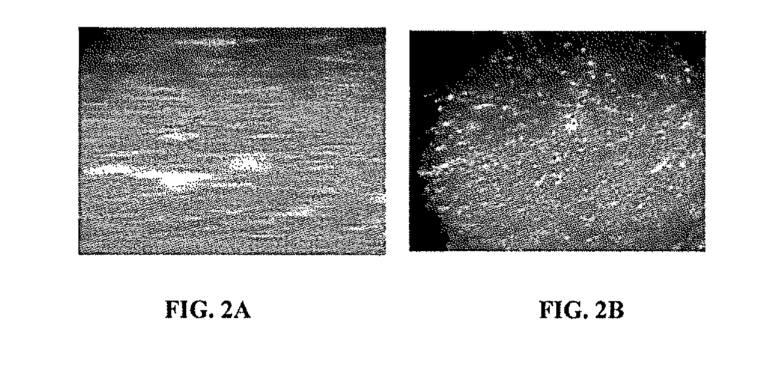 Systems and methods for detection of particles in a beneficial agent