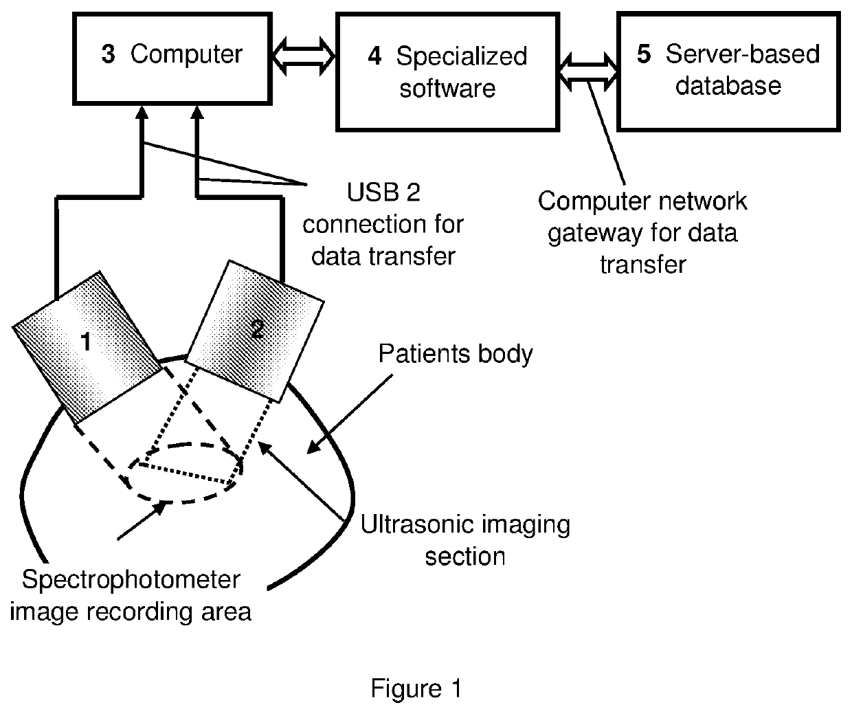 Complex analysis system of spectrophotometry and ultrasound images and data for automatic early-stage diagnosing of malignant skin tumors