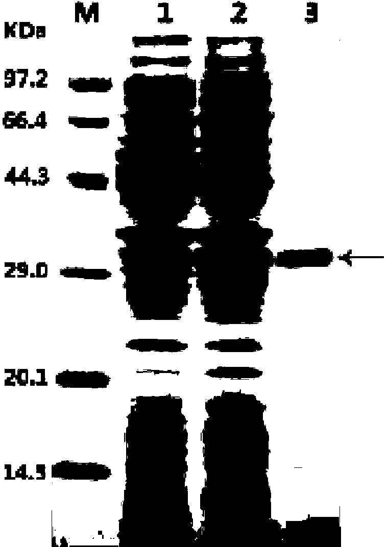 Tertiary alcohol ester hydrolase, encoding gene, carrier, engineering bacteria and application thereof