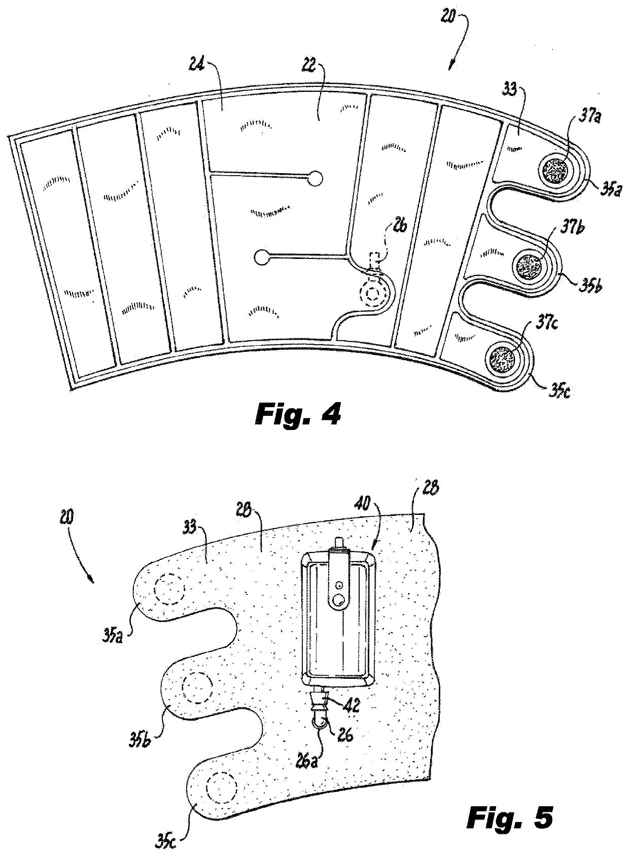 Portable system for the prophylaxis of deep vein thrombosis