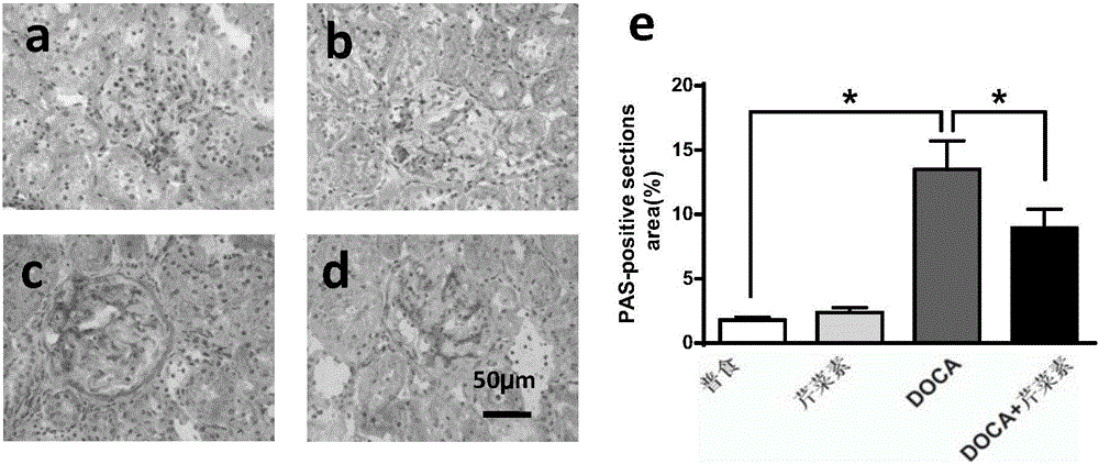 Application of apigenin in preparation of drugs for preventing and treating renal fibrosis