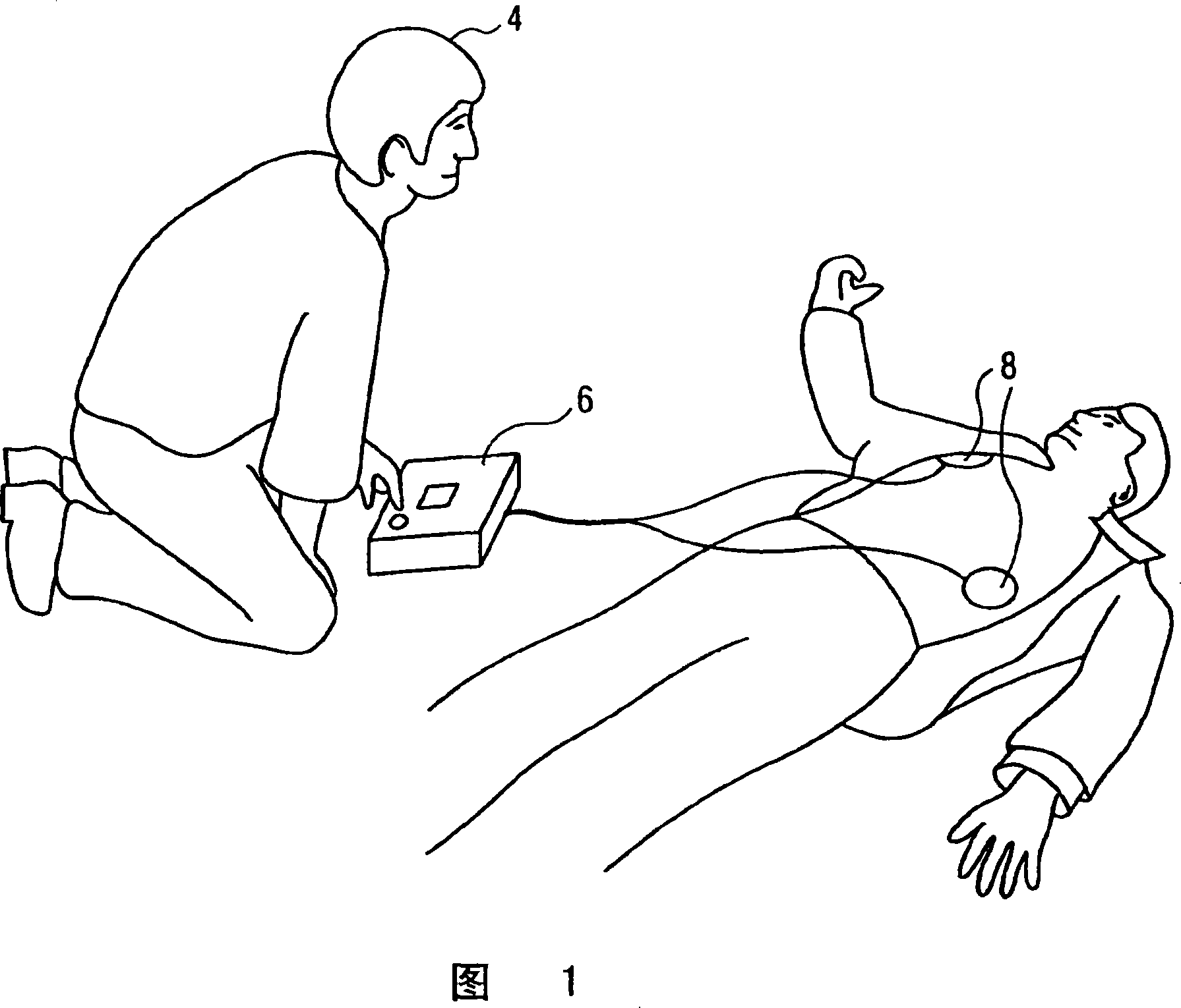 External defibrillator with pre-cpr-ecg based defibrillating shock