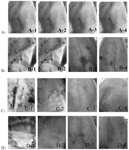 Application of atractylodin in preparation of propionibacterium acnes inhibitor