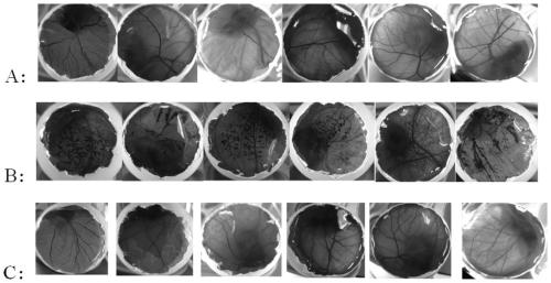 Application of atractylodin in preparation of propionibacterium acnes inhibitor