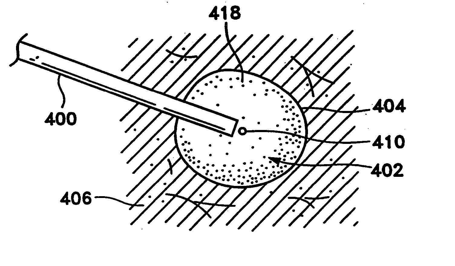 Biopsy cavity marking device and method