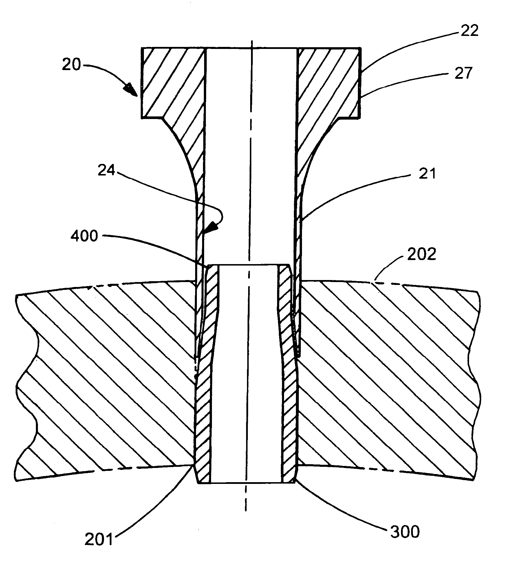 External tube extraction device with a cylindrical collapsing wedge