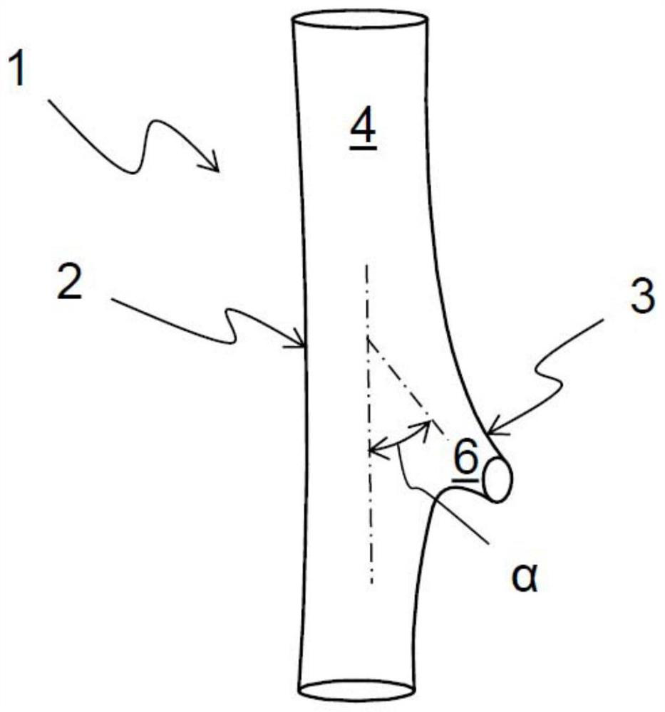 Bifurcated stent and stent system