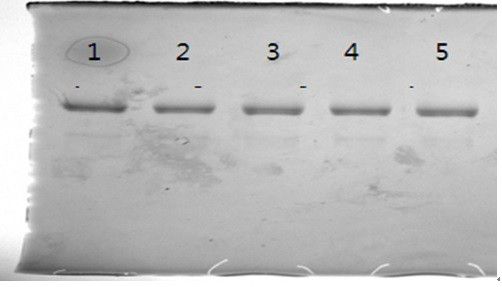 Preparation method of recombinant human glucagon-like peptide-1 analogue fusion protein