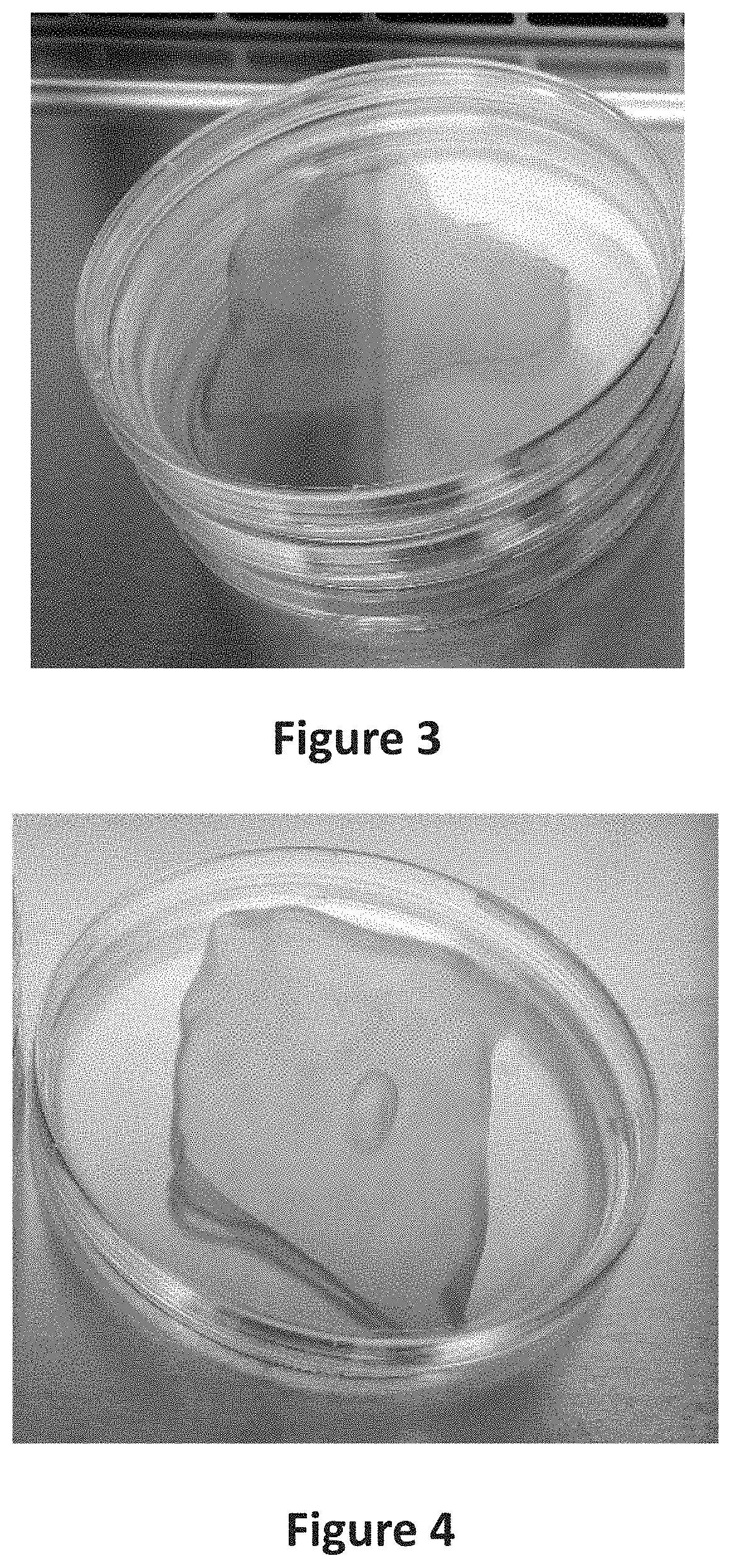 Process for obtaining a functional dermal substitute of decellurized amniotic membrane from the placenta combination with keratinocytes and its use as an agent for tissue regeneration of the skin