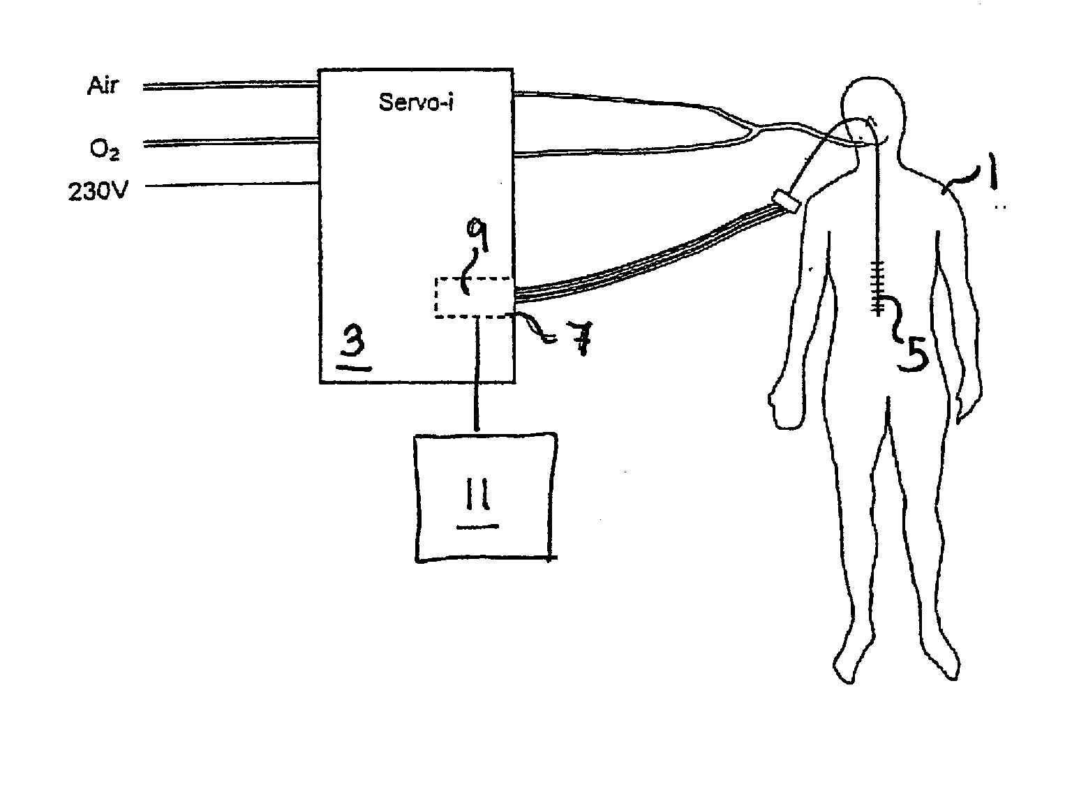 Control unit and display unit for an emg controlled ventilator