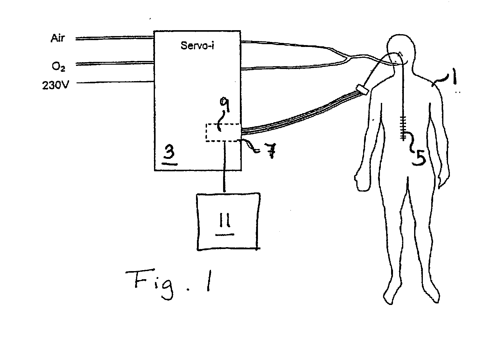 Control unit and display unit for an emg controlled ventilator