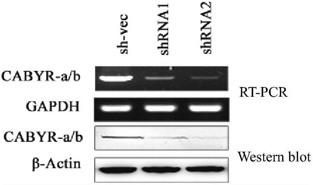 Application of CABYR-a/b to promotion of sensibility of cancer cells to VP16 and TRAIL