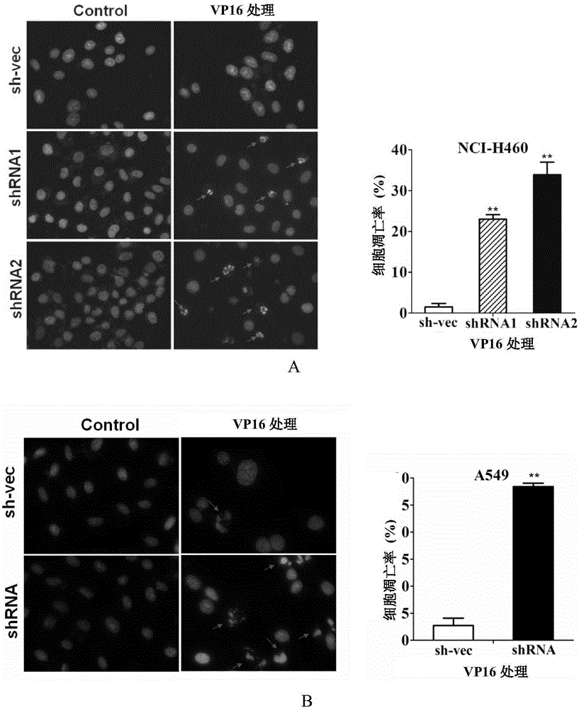 Application of CABYR-a/b to promotion of sensibility of cancer cells to VP16 and TRAIL