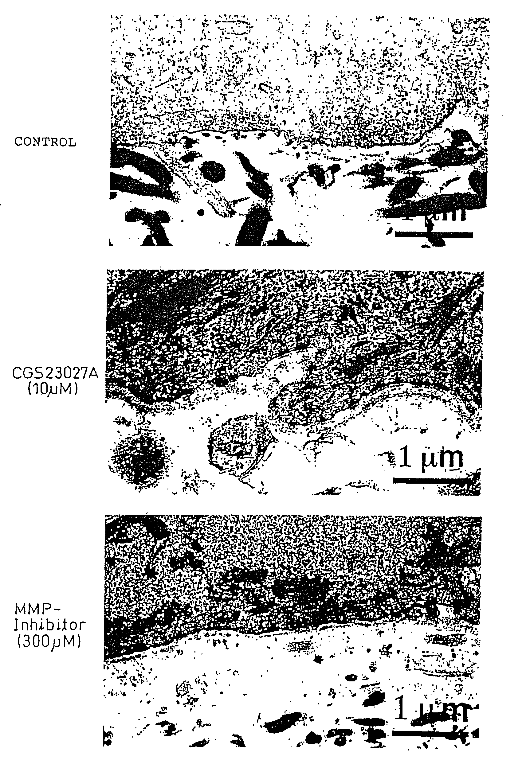 Method of Production of Artificial Skin