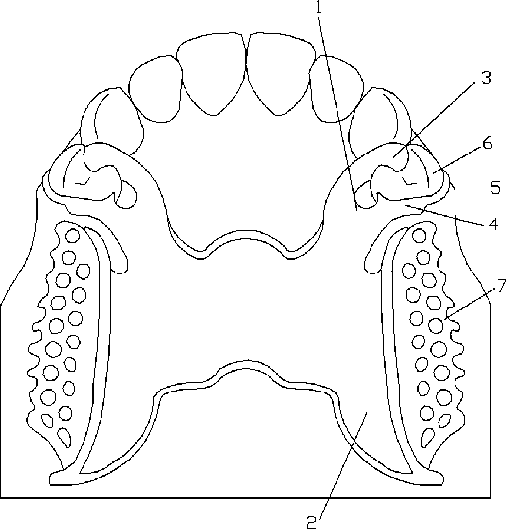 Plate rod snap ring for removable partial denture