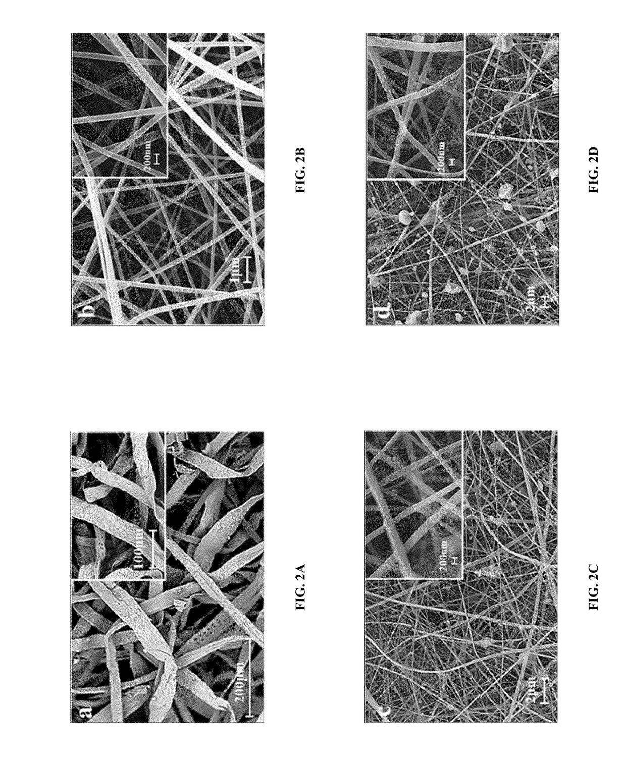 Cellulose acetate based non-woven nanofiber matrix with high absorbency properties for female hygiene products