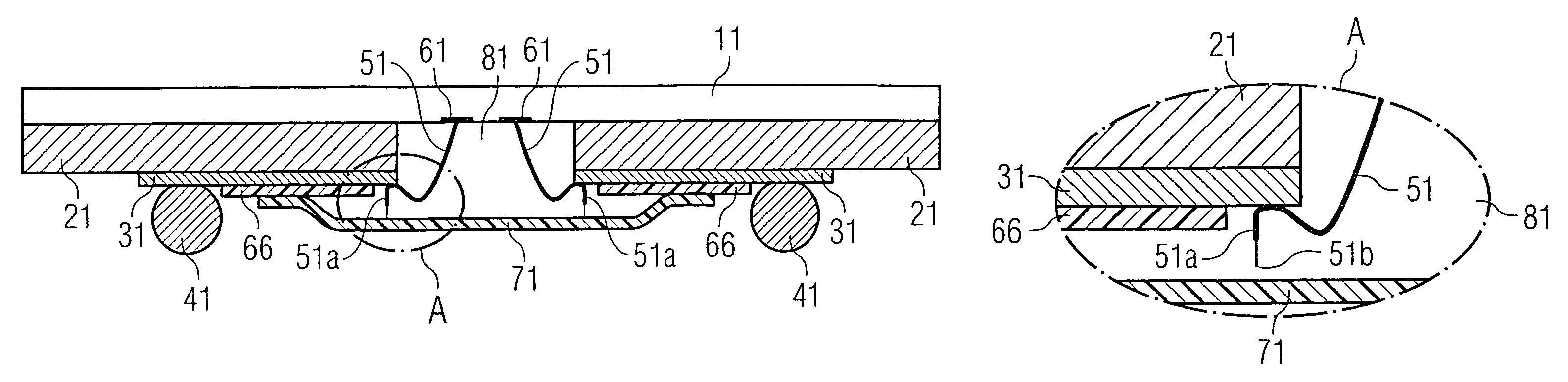 ESD protection apparatus for an electrical device