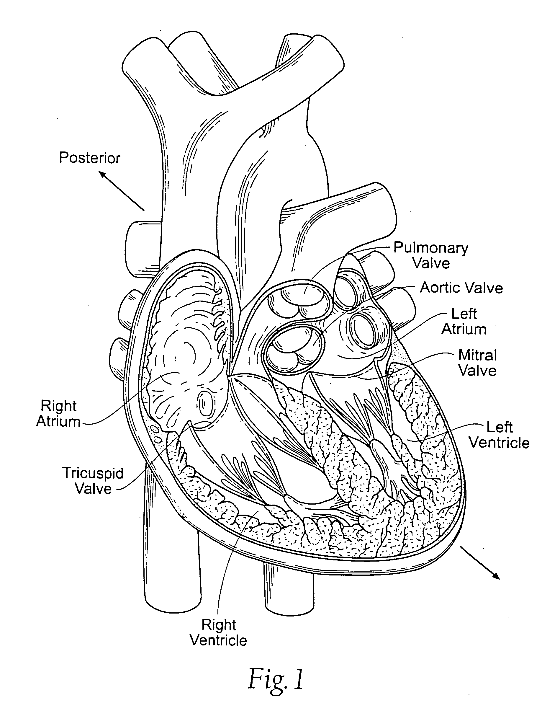 Devices, systems, and methods for supporting tissue and/or structures within a hollow body organ