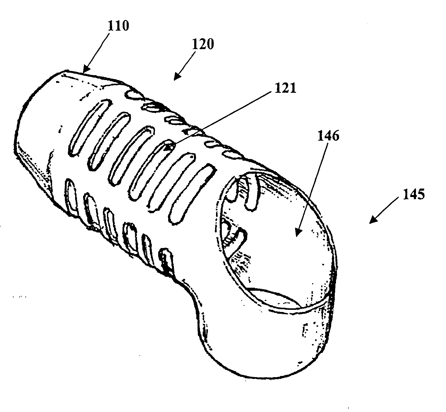 Apparatus and method for connecting a conduit to a hollow organ