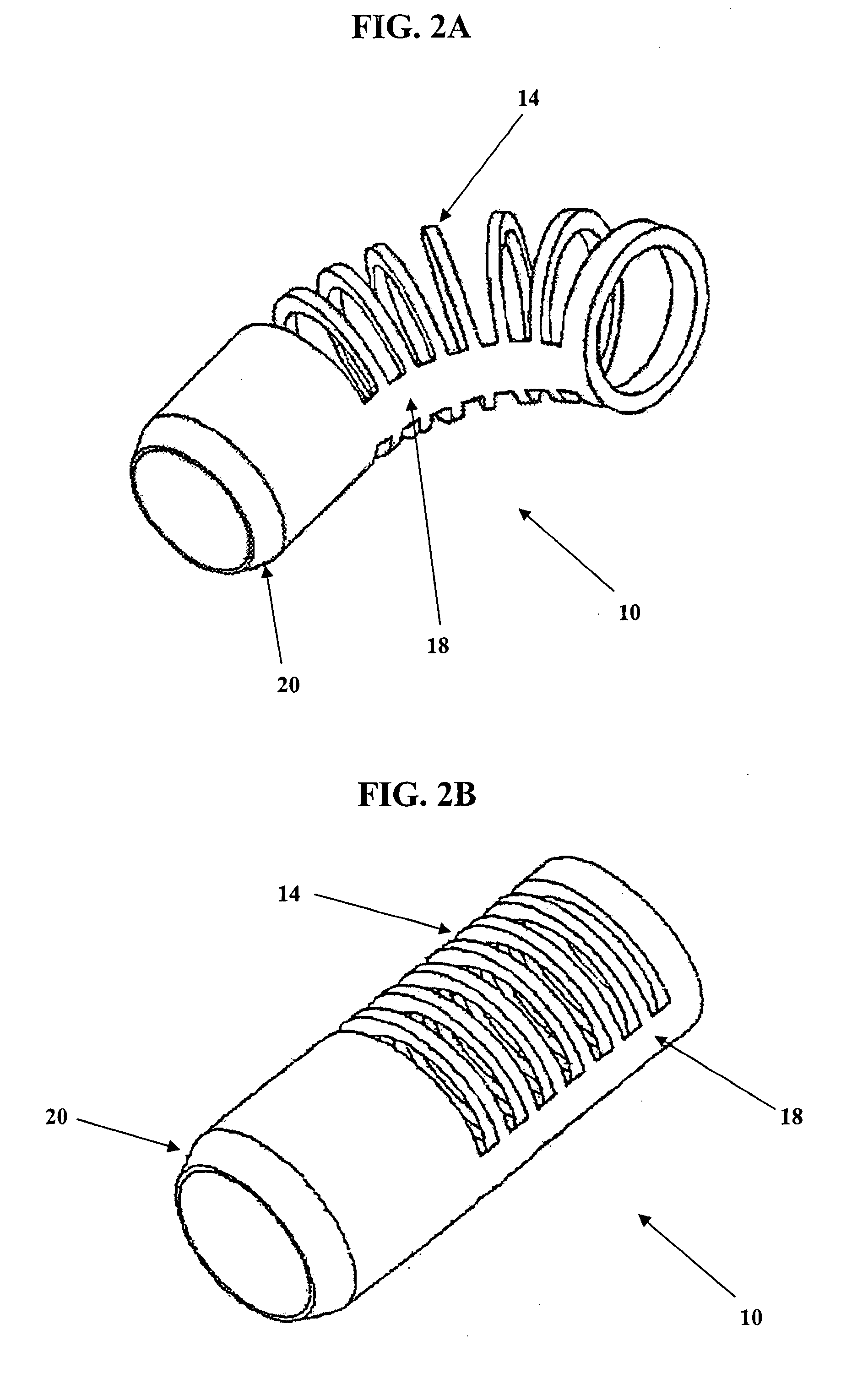 Apparatus and method for connecting a conduit to a hollow organ