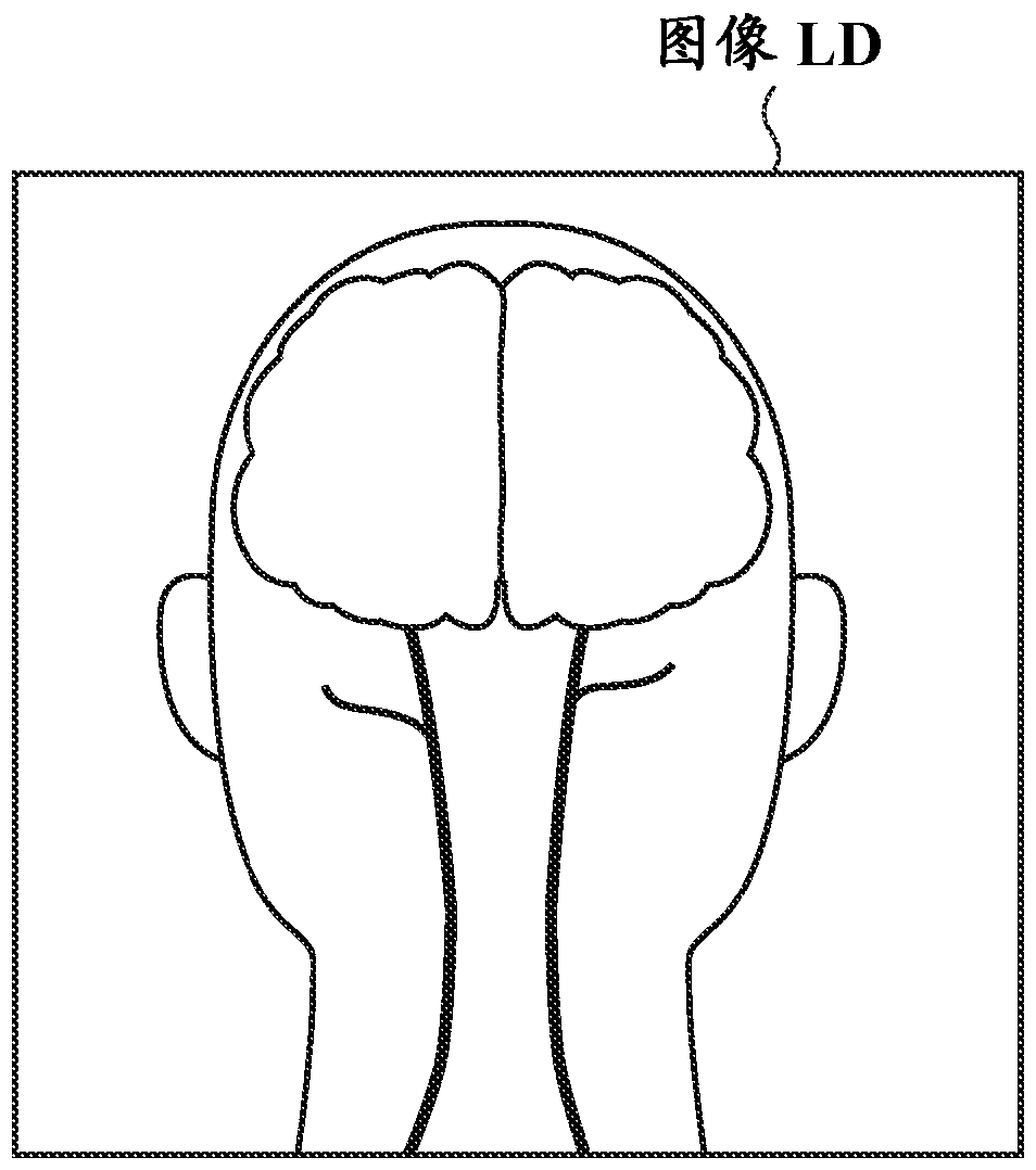 Magnetic resonance equipment