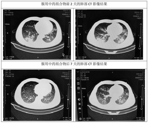 A kind of traditional Chinese medicine composition and its application