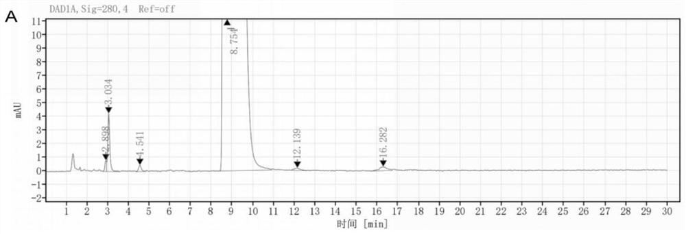 Metoprolol tartrate tablet and preparation method thereof