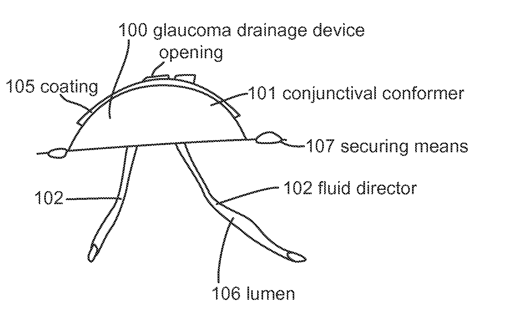 Subconjunctival conformer device and uses thereof