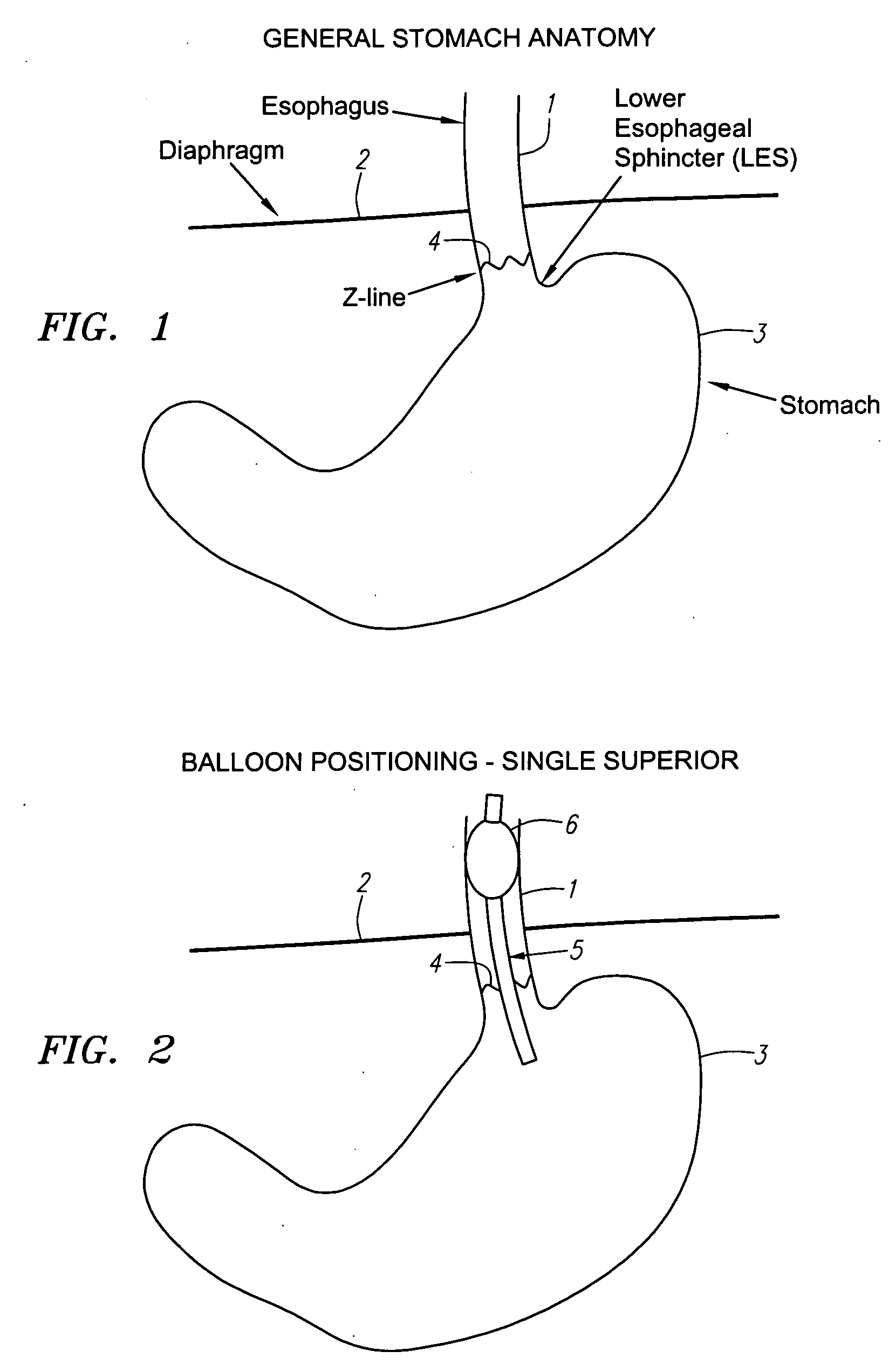 Methods and apparatus for treatment of obesity with an ultrasound device movable in two or three axes