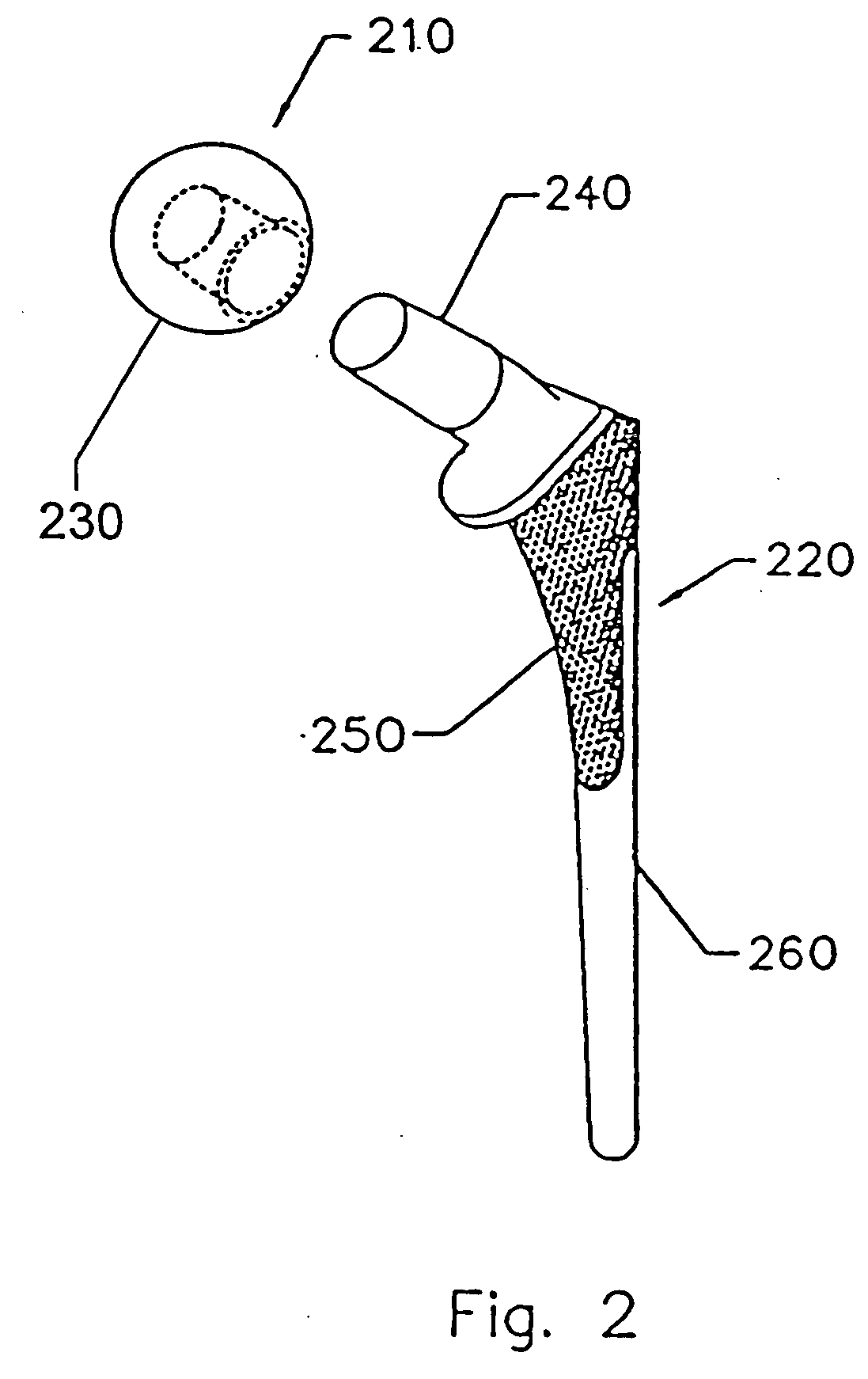 Implant with composite coating