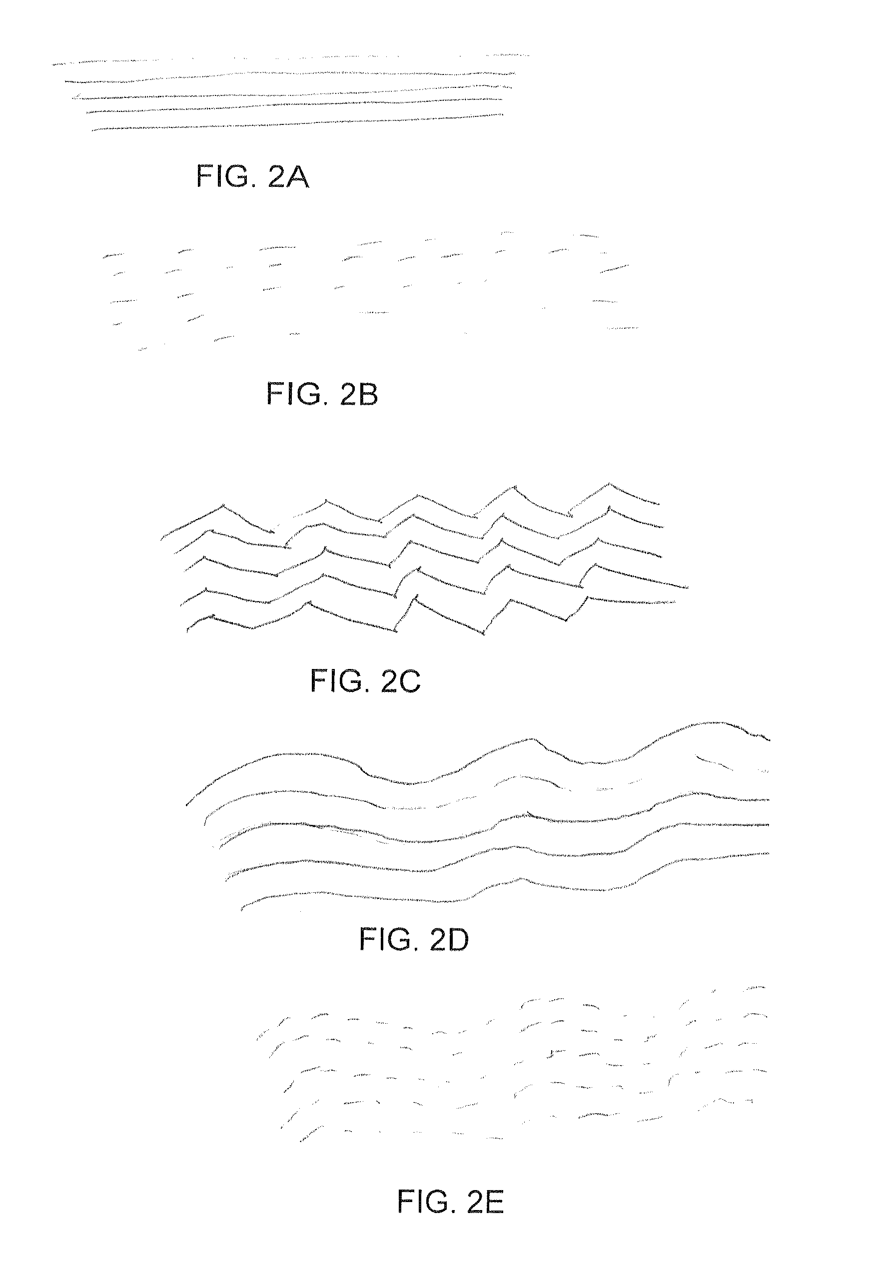 Device and method for treating neuropathy