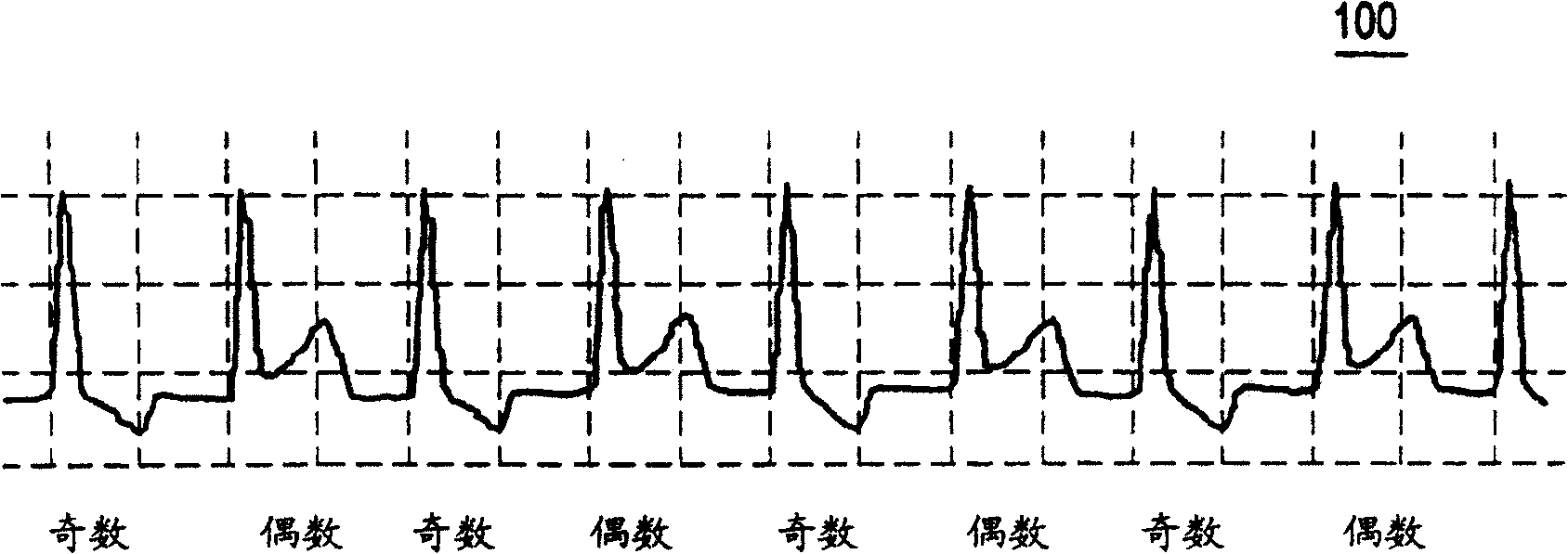 Method and system for improved measurement of t-wave alternative