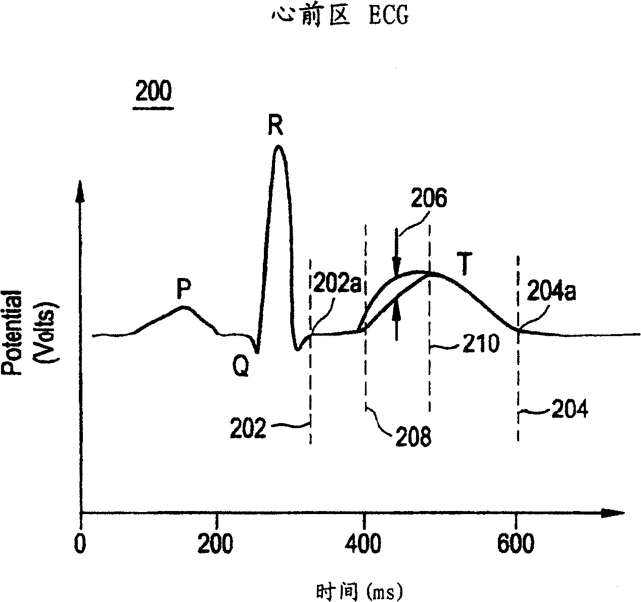 Method and system for improved measurement of t-wave alternative