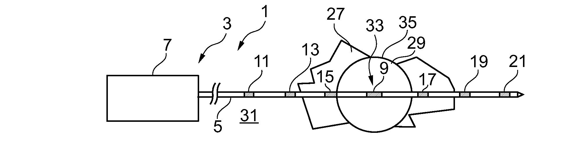 Interventional ablation device with tissue discriminating capability