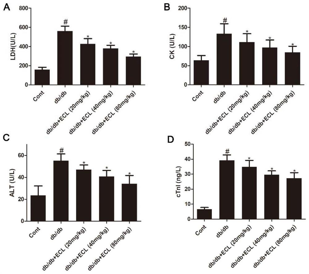 Application of Cyclocarya paliurus extract in preparation of medicine for treating or preventing diabetic cardiomyopathy