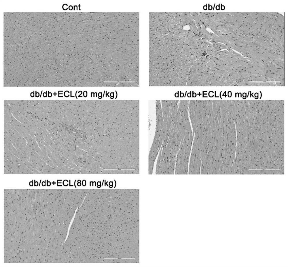 Application of Cyclocarya paliurus extract in preparation of medicine for treating or preventing diabetic cardiomyopathy