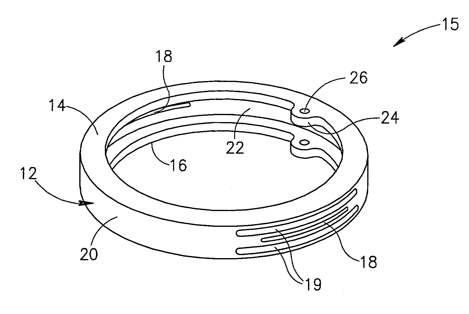 Intraocular ring