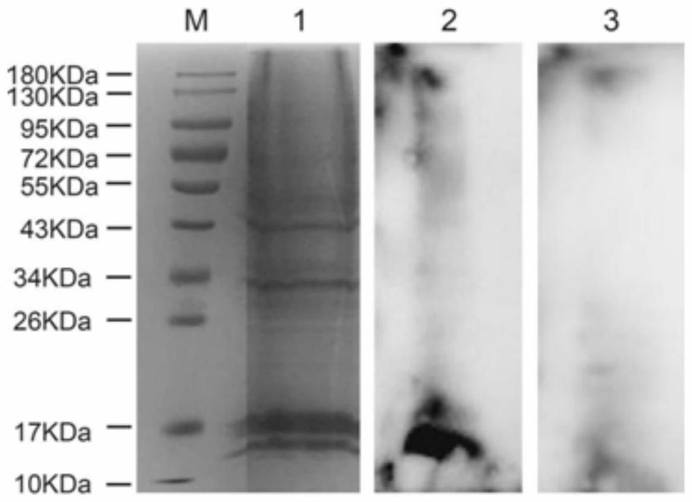 A kind of receptor protein specifically combined with mycoplasma genitalium mgpa and its separation method and application